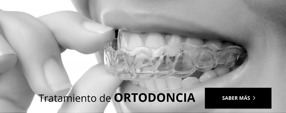 ortodoncia aramaiona